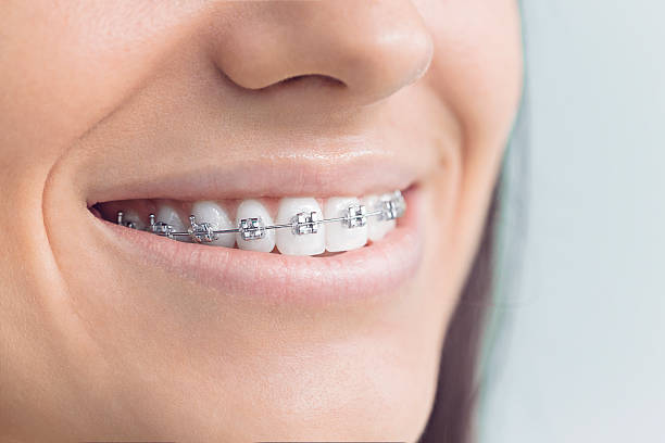 Best Full Mouth Reconstruction  in La Villa, TX
